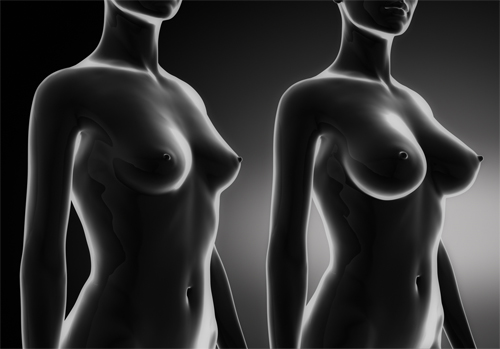 Conférence Esthétique : Les dernières innovations en plastie mammaire