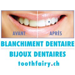 Tooth Fairy Blanchiment dentaires
